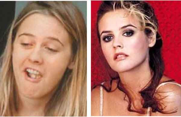 Alicia Silverstone - With And Without Makeup