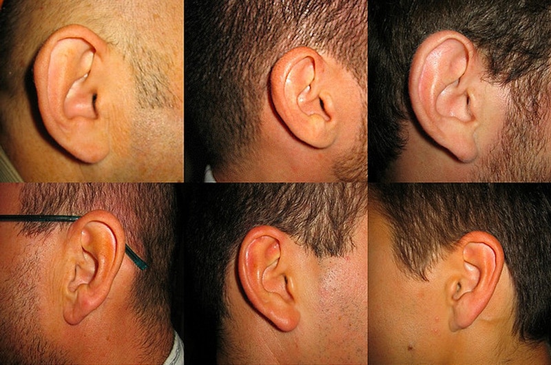 Forget Facial Recognition! Your Ear Is Your New I.D.