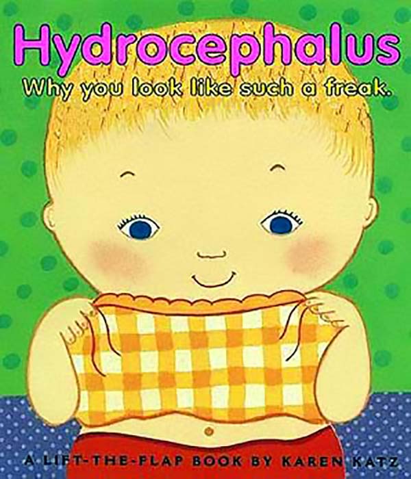 Hydrocephalus: Why You Look Like Such A Freak - Hydrocephalus, The Rejected Children'S Book That Portrays Why Your Look Like A Freak.