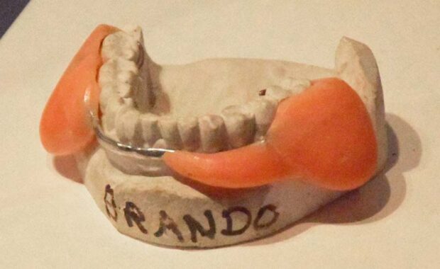 Marlon Brando'S Dental Plumper For 'The Godfather'