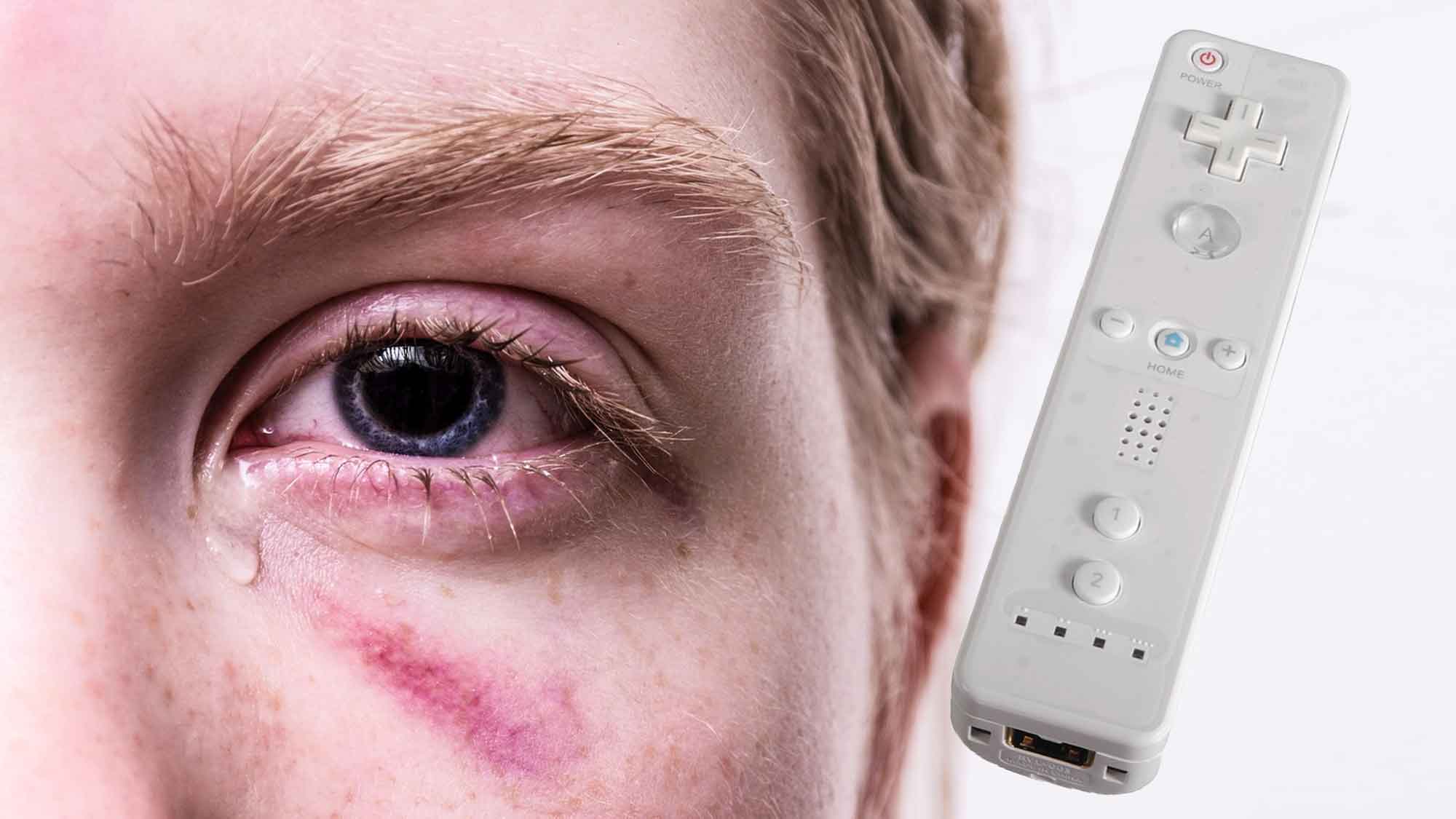 A Pain In The Wii - Reports Of Nintendo Wii Injuries On The Rise (2006)