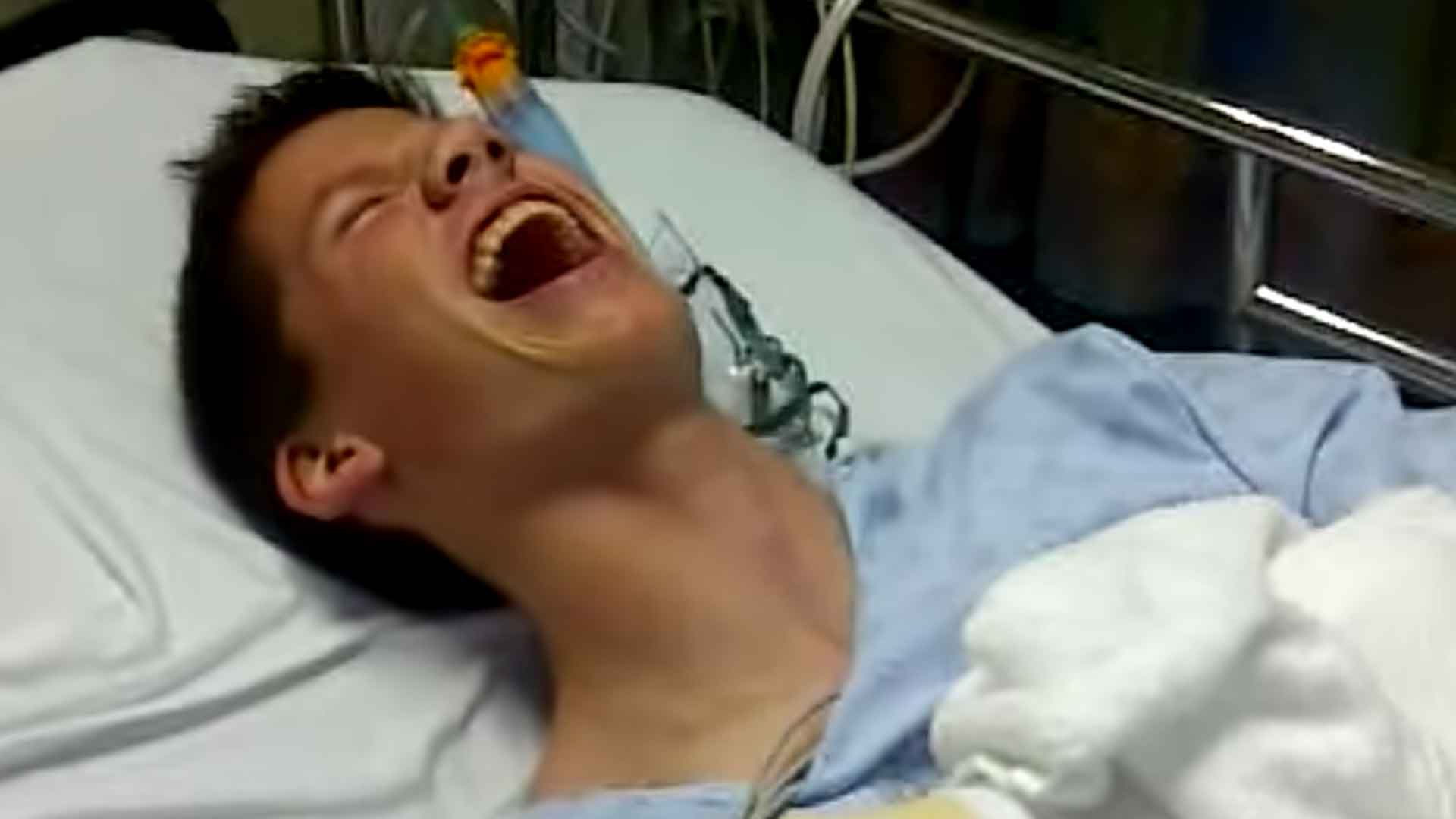 High Teen Can't Stop Laughing at His Broken Arm